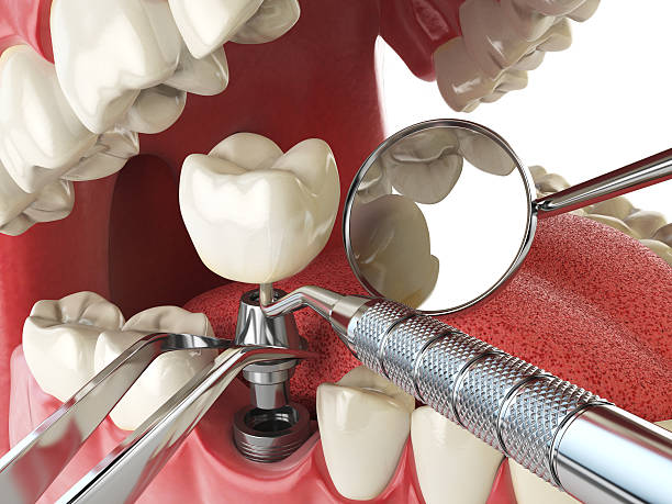Best Emergency Root Canal Treatment in Boston Heights, OH